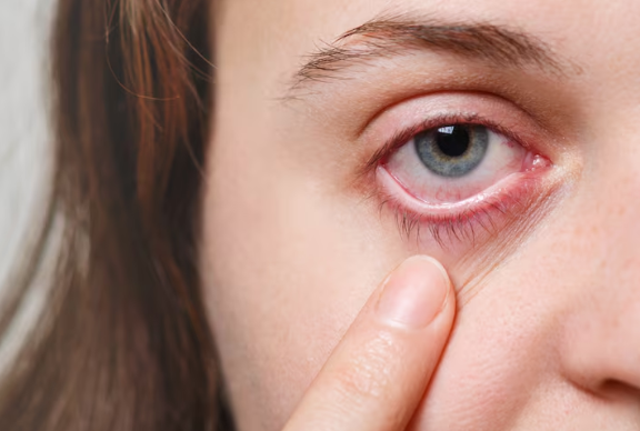 Which Dry Eye Treatment Works Best for Your Symptoms?